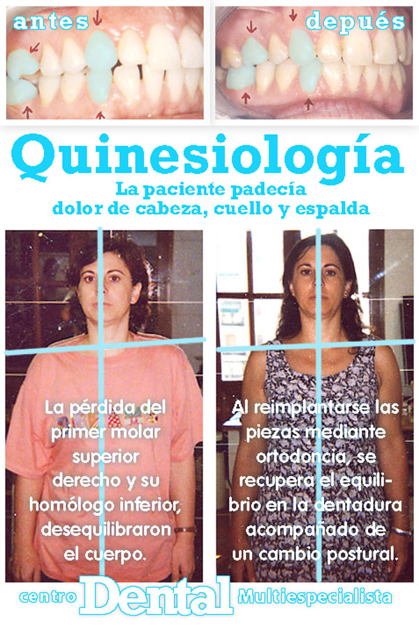 quinesiologia_2_centro_dental_multiespecialista