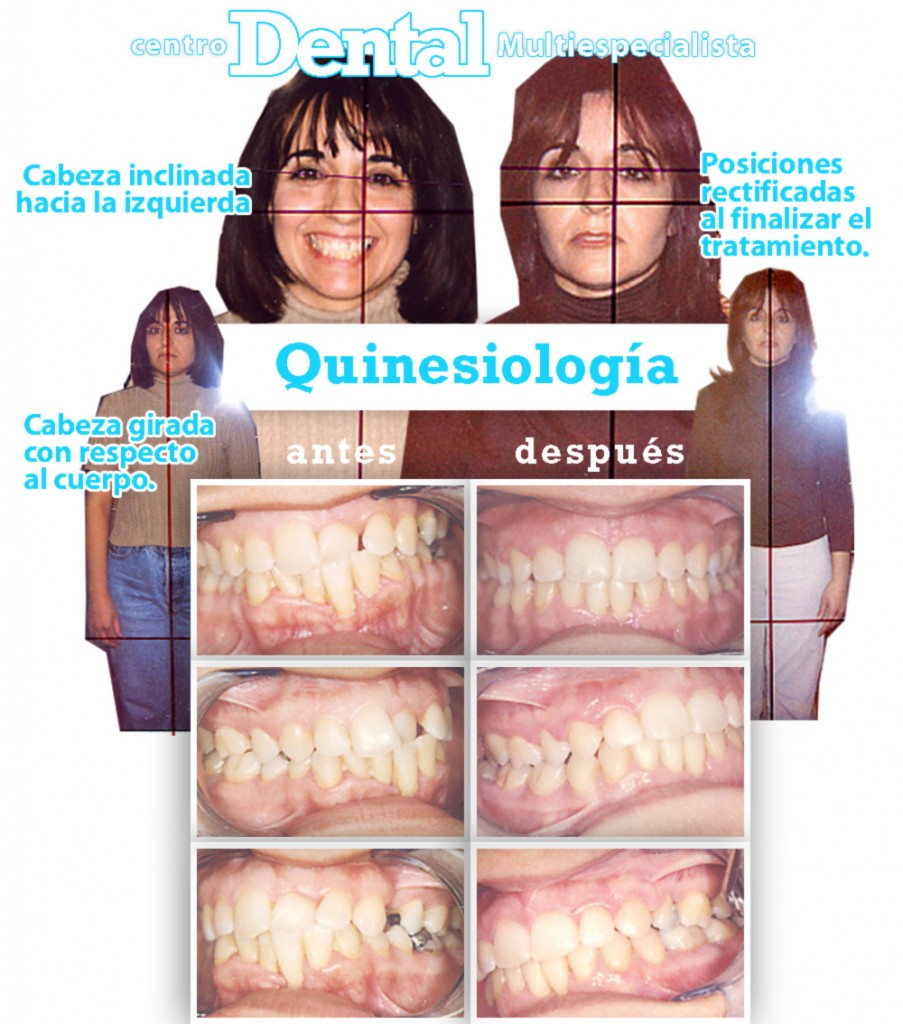 quinesiologia_3_centro_dental_multiespecialista