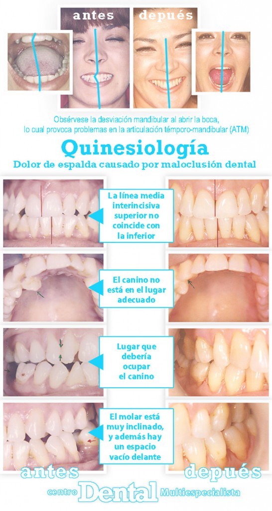 quinesiologia_4_centro_dental_multiespecialista