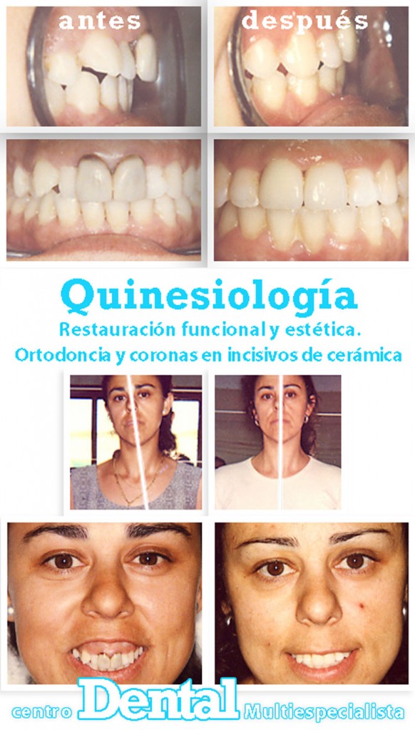 quinesiologia_6_centro_dental_multiespecialista