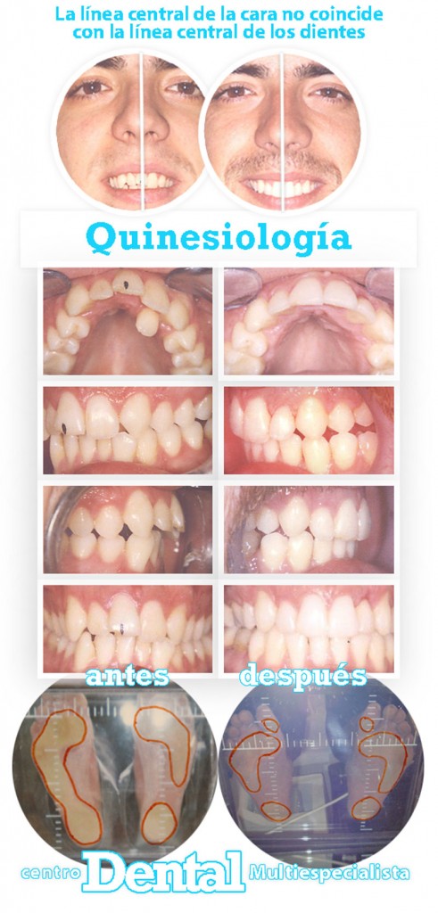 quinesiologia_7_centro_dental_multiespecialista
