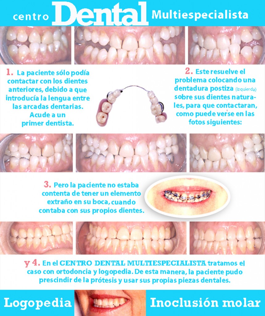 logopedia_centro_dental_multiespecialista_1